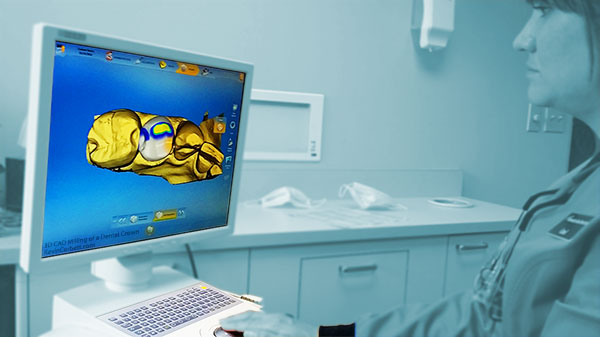 3D CAD Dentistry